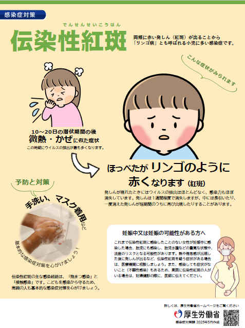 伝染性紅斑