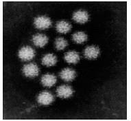 ノロウィルスの電子顕微鏡写真