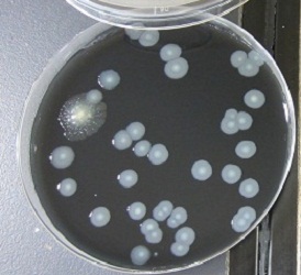 レジオネラ属菌